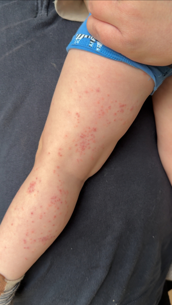 Does anyone know what this could be on my son’s leg.