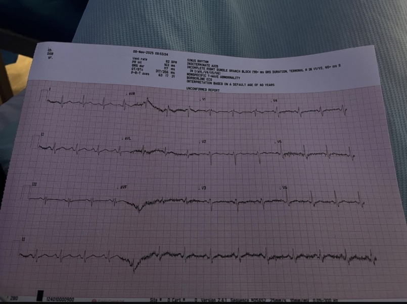 Ecg reading (photo attached)