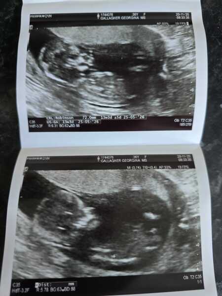 5 weeks and no symptoms - not even sore boobs