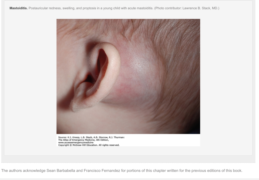 Bony lump on 10 month old baby's skull
