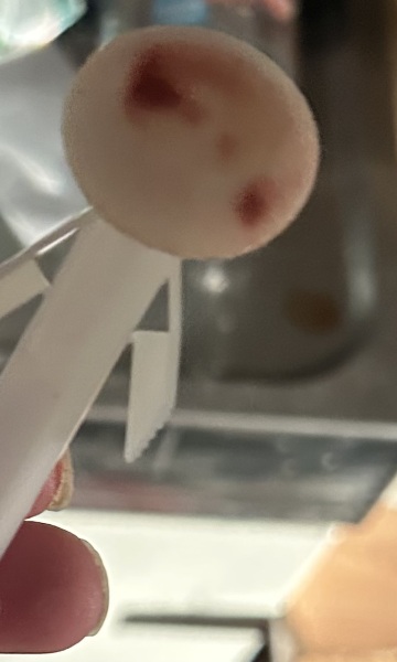What are these items please
