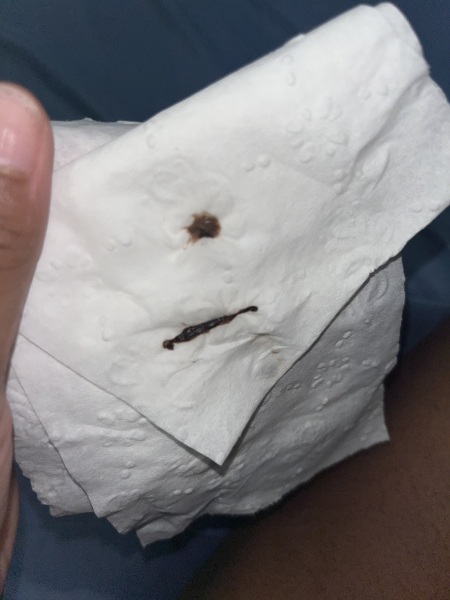 Roughly 5 weeks and brown bleeding...
