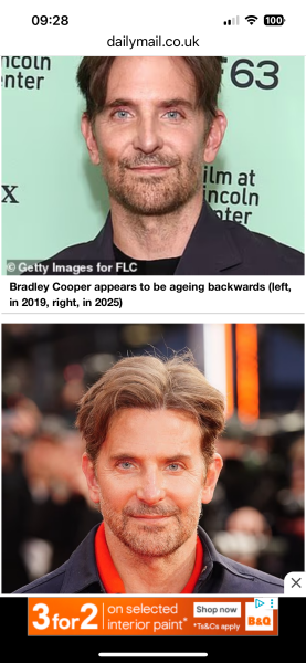 I really do not like DH new look after having cosmetic surgery!