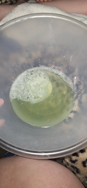 Very pale green vomit