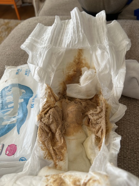 is this normal coloured poop?