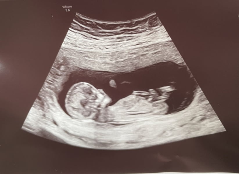 Boy or girl? Nun theory