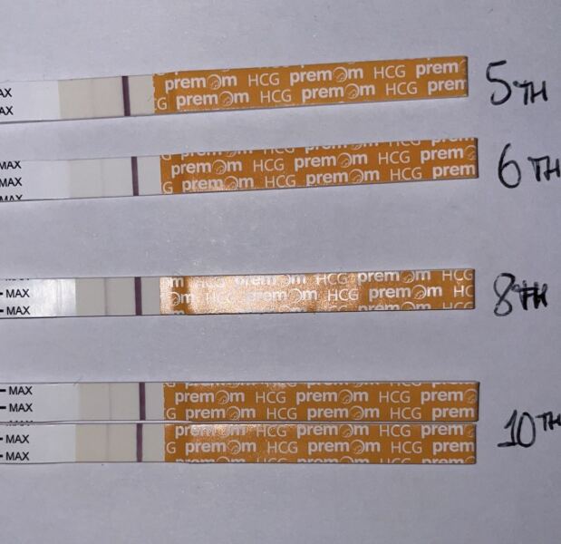 Is this a chemical? (Pics) Two consecutive miscarriages?