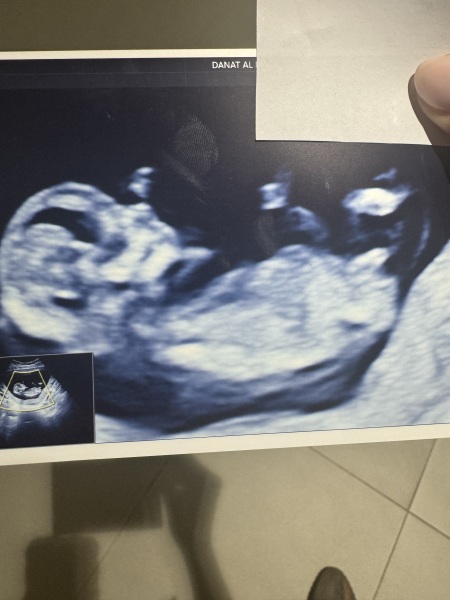 Nub Theory 12 weeks 3 days