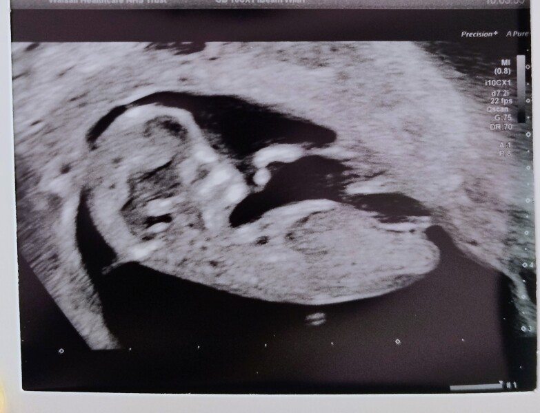 Boy or girl :)