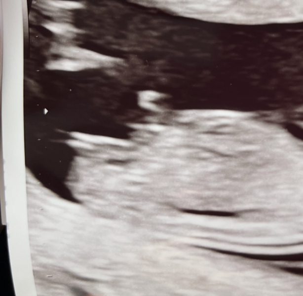 Boy or girl