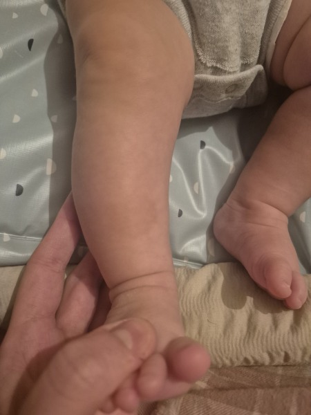 Is this a cafe au lait spot?