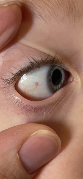DD4’s eye, normal?! (Posting for traffic)