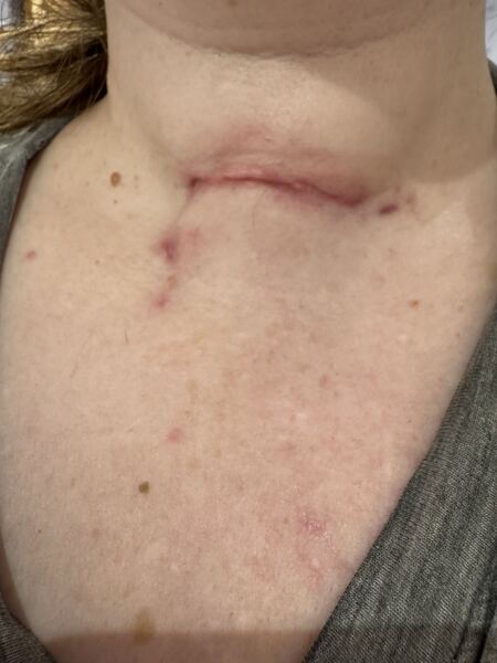 Will this scar get any better?