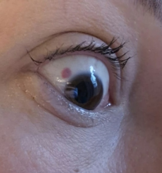 DD4’s eye, normal?! (Posting for traffic)