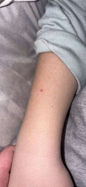 Should i be concerned