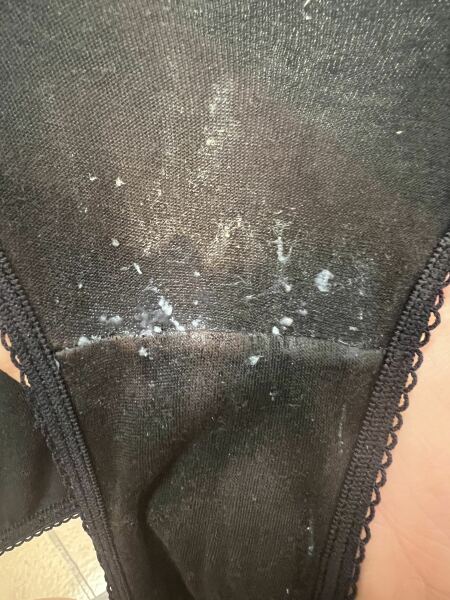 Thrush?