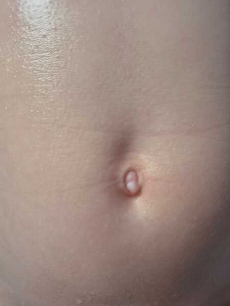 Child's bellybutton