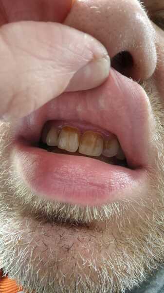 Discoloured teeth - just appeared.  Emergency?