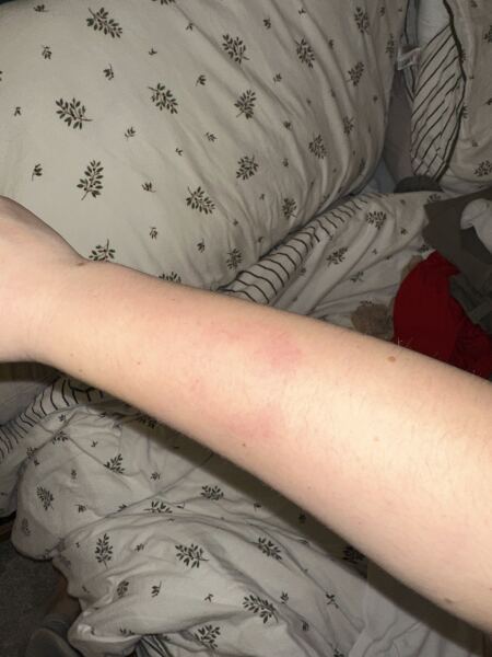 To tell my sister I don’t want to see her anymore if she doesn’t discipline my nephew for biting me?