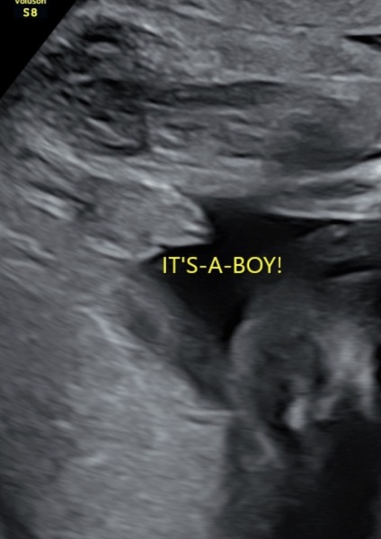 Gender scan, definitely a boy?