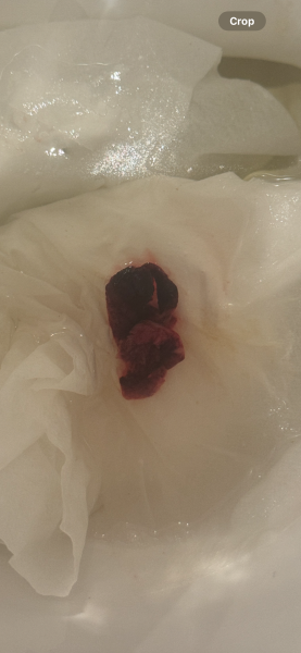 TMI: Never experienced this before on my period