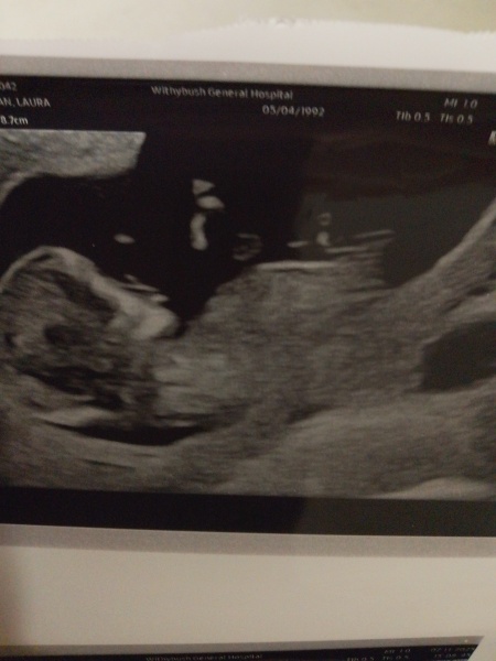 First scan
