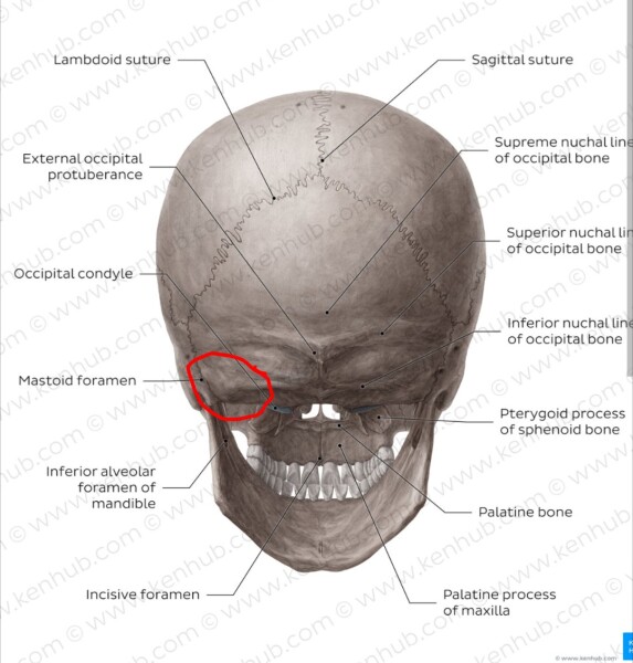 Bony lump on 10 month old baby's skull