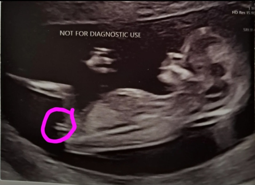Can anyone understand the nub theory?