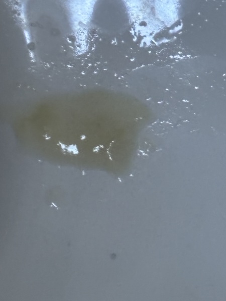 Mucus plug?,