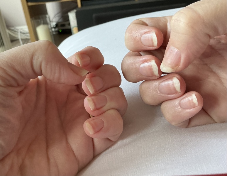 Terrible nails after builder gel removal