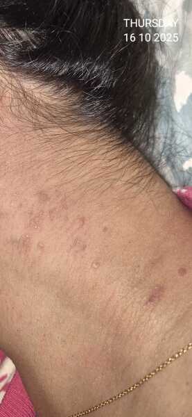 Unknown neck rash?!