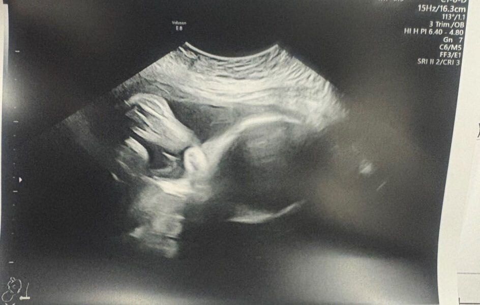 Due January 2026 - Thread 3