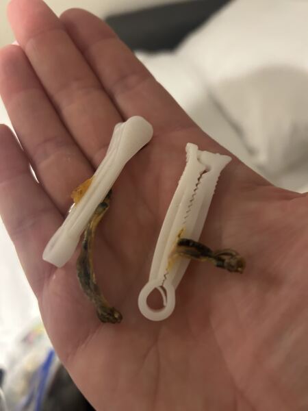 What Do You Do With Your Childrens Teeth?