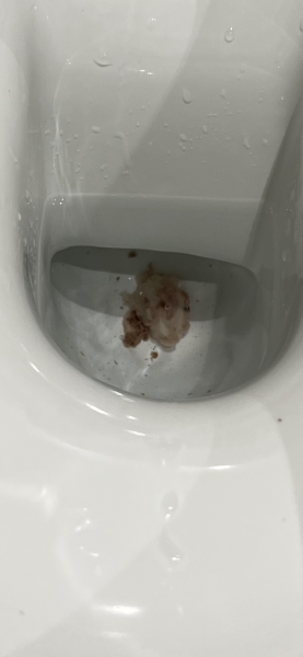 Mucus plug?
