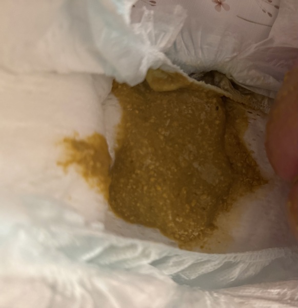 Watery poo formula fed