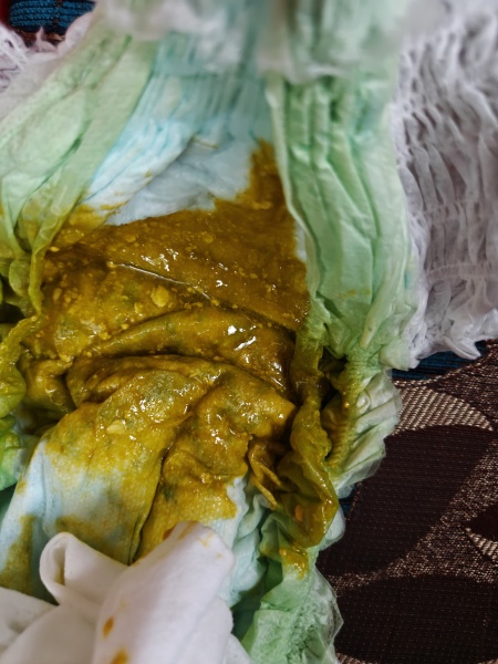 Is this normal bf baby poop?!