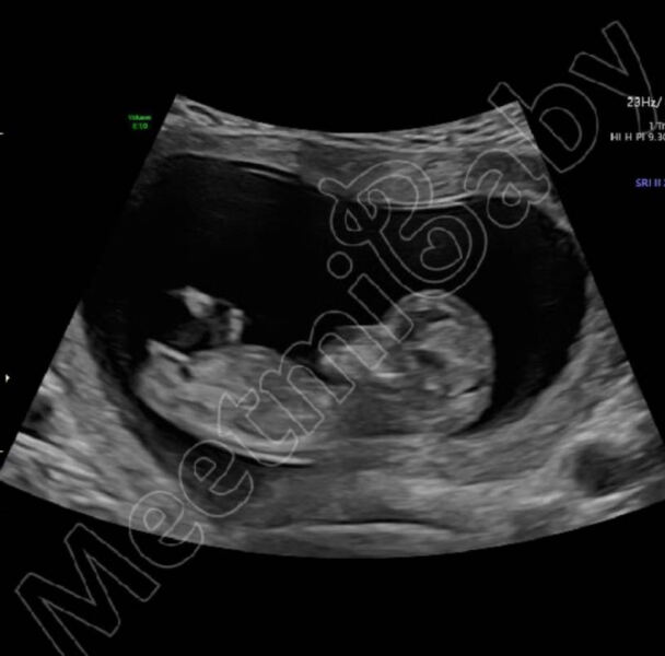 Nub and skull theory guesses - 12W 1 day