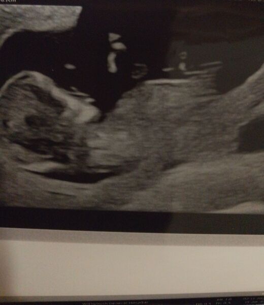 First scan