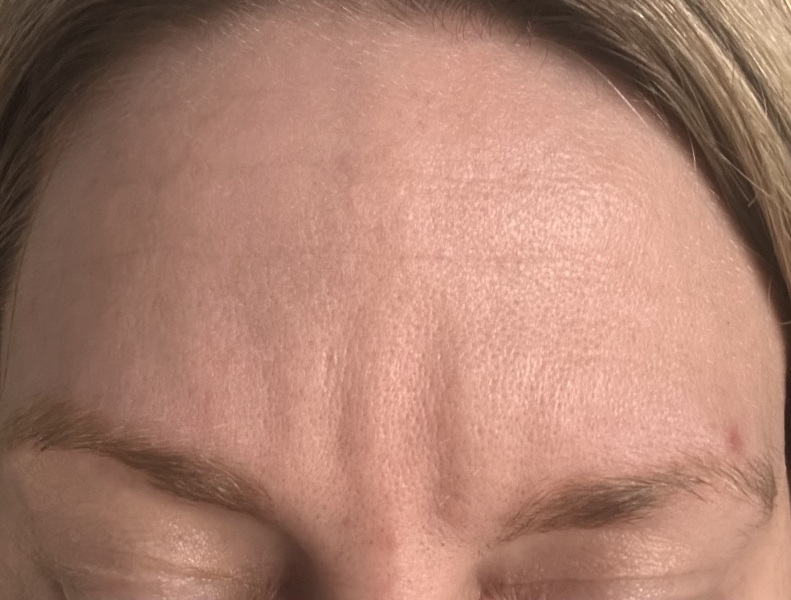 How to fix my forehead!!!! Hate it!!