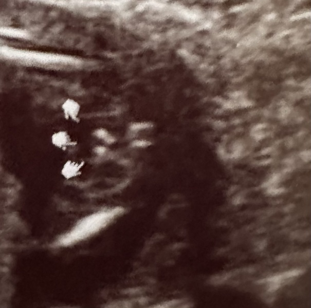 Potty shot confirmation