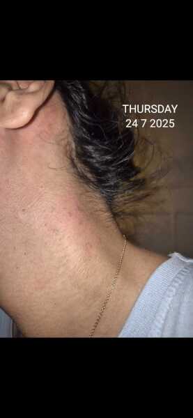 Unknown neck rash?!