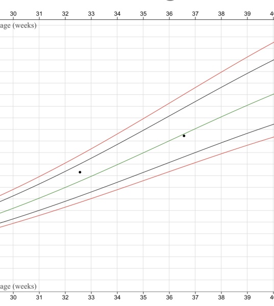 Growth scan should I be concerned