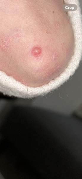 This this small spot look “normal”