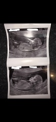 Gender guesses????!