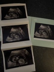 13 week scan…any guesses on gender?