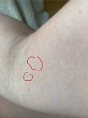 What are these round dots on my arms