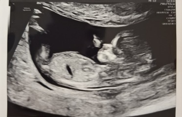 Boy or girl?