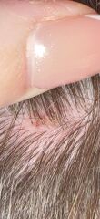 What’s on my scalp 😬