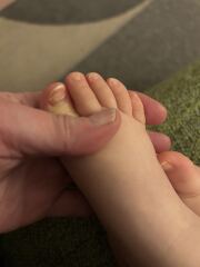 Toddler Toenail