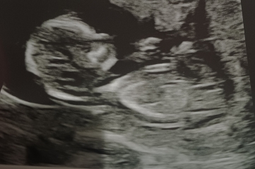 Due june 2026 gender gusse